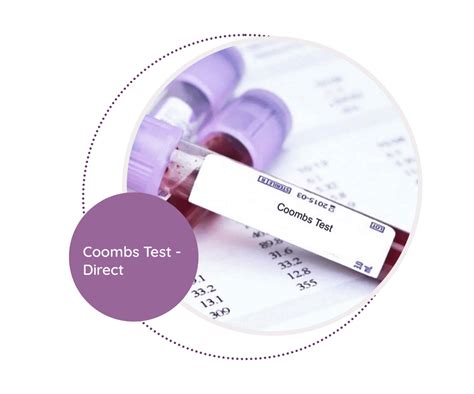 coombs test blood bottle|coombs blood test before transfusion.